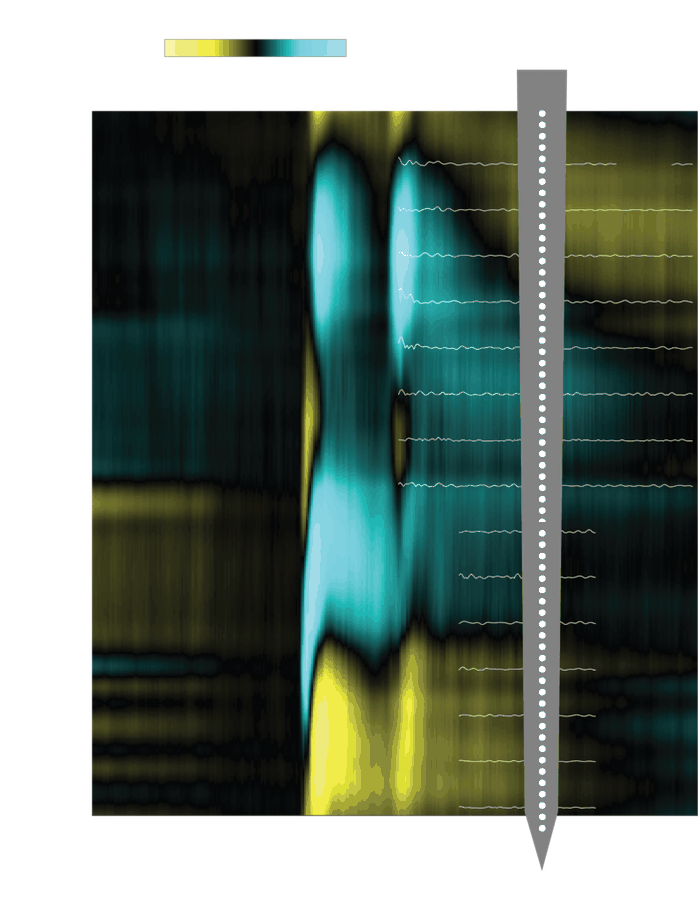 Electrophysiology