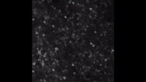 Two-photon imaging